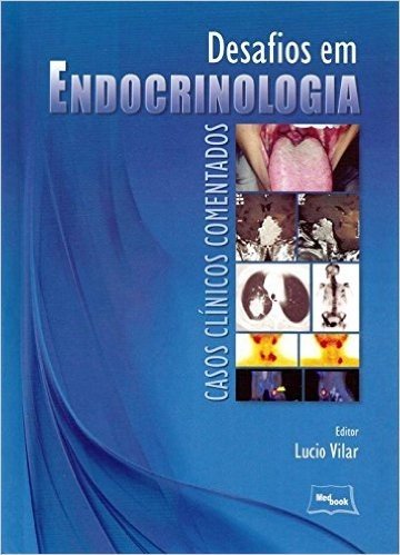 Desafios em Endocrinologia. Casos Clínicos Comentados