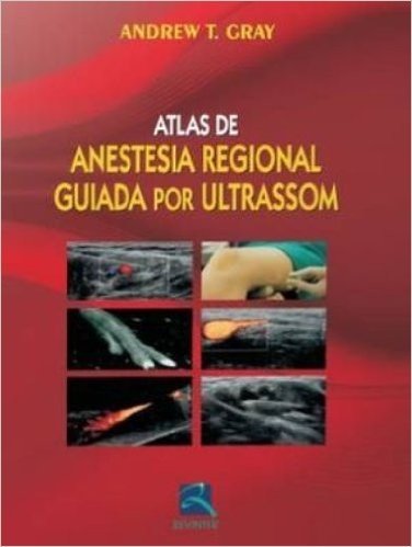 Atlas De Anestesia Regional Guiada Por Ultrassom