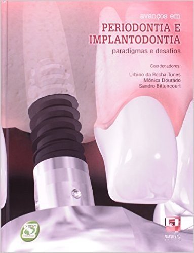 Avancos Em Periodontia E Implantodontia