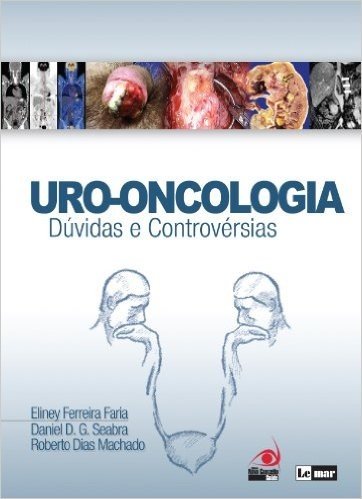 Uro-Oncologia