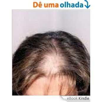 Caída de pelo: For Women. Todo o que precisa saber (Galician Edition) [eBook Kindle]
