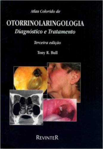 Atlas Colorido De Otorrinolaringologia. Diagnostico E Tratamento