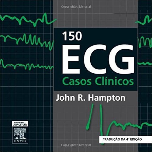 150 ECG Casos Clínicos