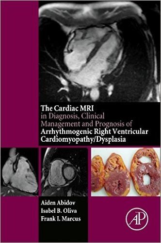 The Cardiac MRI in Diagnosis, Clinical Management, and Prognosis of Arrhythmogenic Right Ventricular Cardiomyopathy/Dysplasia