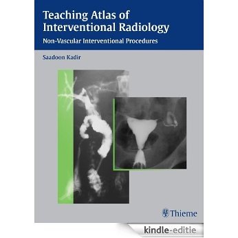 Teaching Atlas of Interventional Radiology: Non-Vascular Interventional Procedures (Teaching Atlas Series) [Kindle-editie]