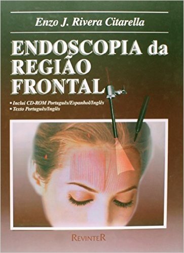 Endoscopia Da Regiao Frontal