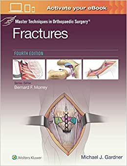 Fractures (Master Techniques in Orthopaedic Surgery)
