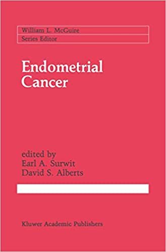 Endometrial Cancer (Cancer Treatment and Research (49))