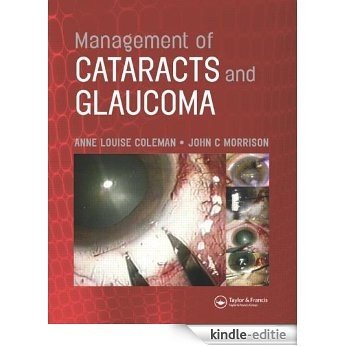 Management of Cataracts and Glaucoma [Kindle-editie]