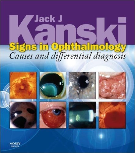 Signs in Ophthalmology: Causes and Differential Diagnosis