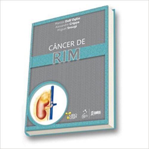 Cancer De Rim. Tumores Malignos