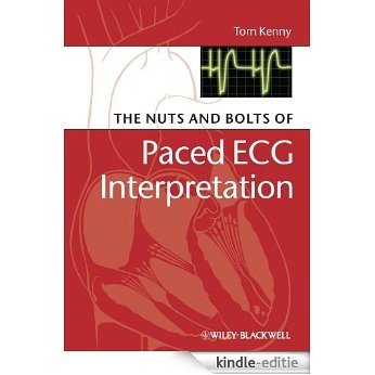 The Nuts and bolts of Paced ECG Interpretation (Nuts and Bolts Series (Replaced by 5113)) [Kindle-editie]