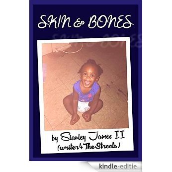 Skin & Bones (English Edition) [Kindle-editie]