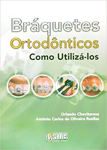 Braquetas Ortodonticos. Como Utiliza-Los