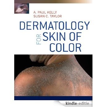 Dermatology for Skin of Color [Kindle-editie]