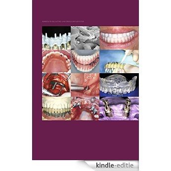 Immediate belasting van orale implantaten [Kindle-editie]