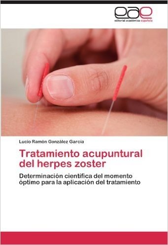 Tratamiento Acupuntural del Herpes Zoster