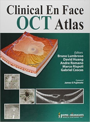 Clinical En Face OCT Atlas baixar