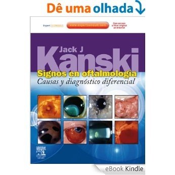 Signos en oftalmología + ExpertConsult: Causas y diagnóstico diferencial [eBook Kindle]