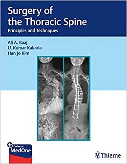 indir Surgery of the Thoracic Spine: Principles and Techniques