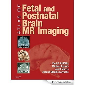 Atlas of Fetal and Infant Brain MR [Kindle-editie]