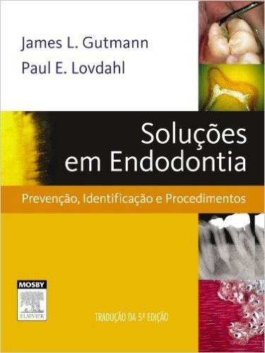 Solução de Problemas de Endodontia baixar