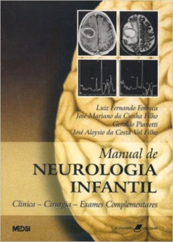 Manual de Neurologia Infantil. Clínica. Cirurgia. Exames Complementares