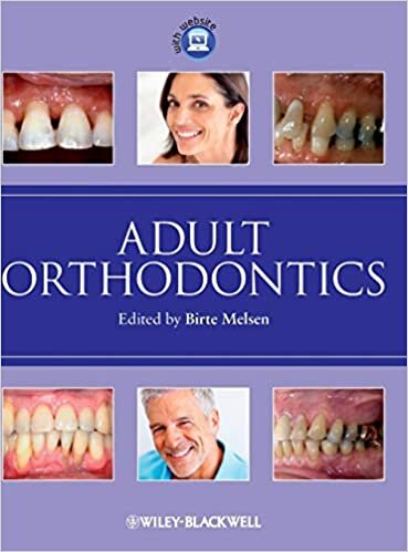 indir Adult Orthodontics