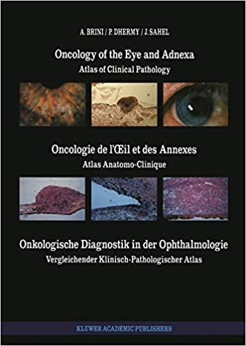 Oncology of the Eye and Adnexa / Oncologie de l'Œil et des Annexes / Onkologische Diagnostik in der Ophthalmologie: Atlas of Clinical Pathology / ... Atlas (Monographs in Ophthalmology)