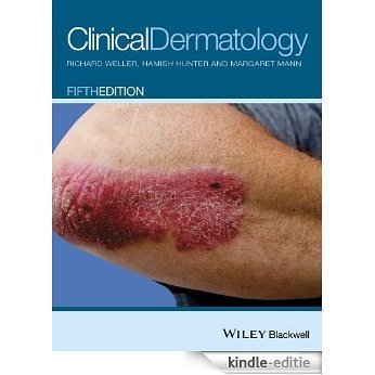 Clinical Dermatology [Kindle-editie]