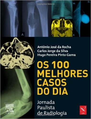 Os 100 Melhores Casos do Dia. Jornada Paulista de Radiologia
