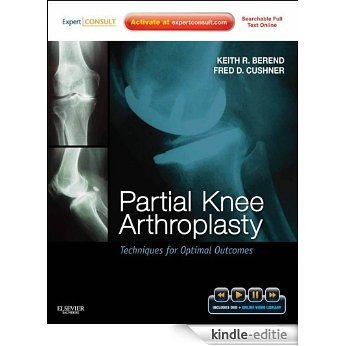 Partial Knee Arthroplasty: Techniques and Optimal Outcomes - Expert Consult [Kindle-editie]