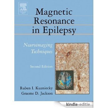 Magnetic Resonance in Epilepsy: Neuroimaging Techniques, Second Edition [Kindle-editie]