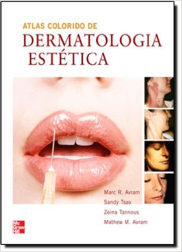 Atlas Colorido de Dermatologia Estética