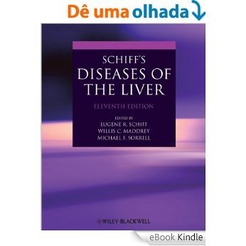 Schiff's Diseases of the Liver [eBook Kindle]