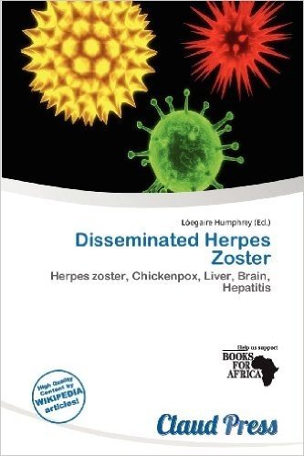Disseminated Herpes Zoster baixar