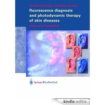 Fluorescence Diagnosis and Photodynamic Therapy of Skin Diseases: Atlas and Handbook [Kindle-editie]