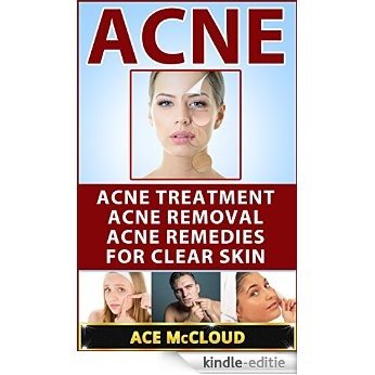 Acne: Acne Treatment: Acne Removal: Acne Remedies For Clear Skin (Acne Skin Care Treatments From Diet & Medical Treatments To All Natural Remedies Including ... Removal For Clear Skin) (English Edition) [Kindle-editie]