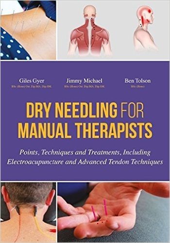 Dry Needling for Manual Therapists: Points, Techniques and Treatments, Including Electroacupuncture and Advanced Tendon Techniques baixar