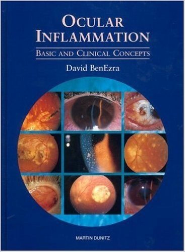 Ocular Inflammation