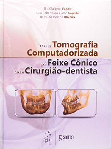 Atlas De Tomografia Computadorizada Por Feixe Conico Para O Cirurgiao-Dentista