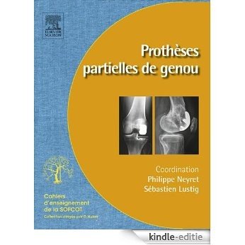 Prothèses partielles du genou: Prothèses unicompartimentaires et fémoropatellaires [Kindle-editie] beoordelingen
