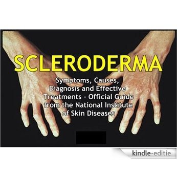 SCLERODERMA: Symptoms, Causes, Diagnosis and Effective Treatments - Official Guide from the National Institute of Skin Diseases (English Edition) [Kindle-editie]