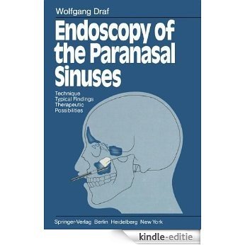 Endoscopy of the Paranasal Sinuses: Technique · Typical Findings Therapeutic Possibilities [Kindle-editie]