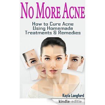 No More Acne: How to Cure Acne Using Homemade Treatments & Remedies (English Edition) [Kindle-editie]