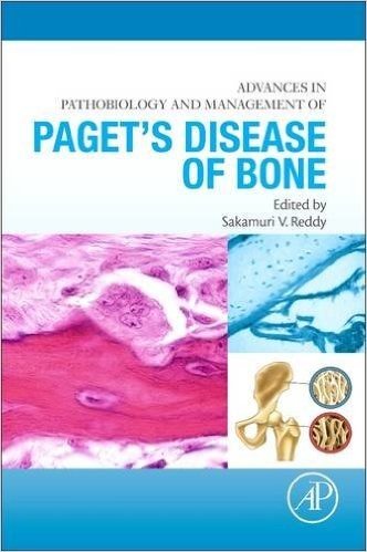 Advances in Pathobiology and Management of Paget S Disease of Bone