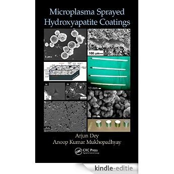 Microplasma Sprayed Hydroxyapatite Coatings [Print Replica] [Kindle-editie]