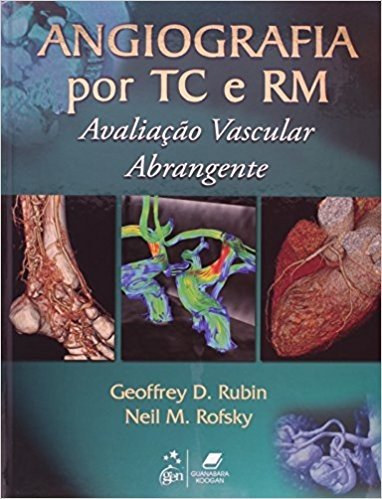 Angiografia por TC e RM. Avaliação Vascular Abrangente