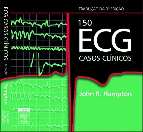 150 Ecg Casos Clinicos