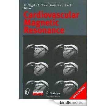 Cardiovascular Magnetic Resonance [Kindle-editie]